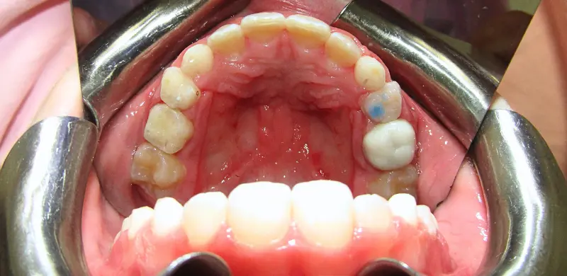 Rafaella center After